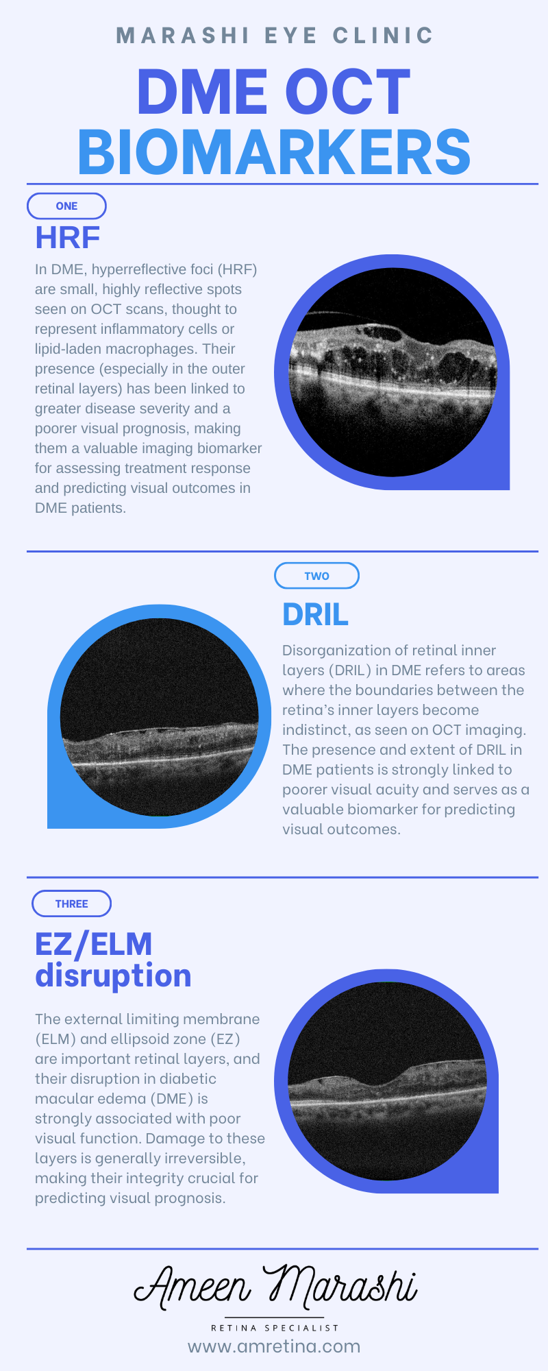DME OCT Biomarkers