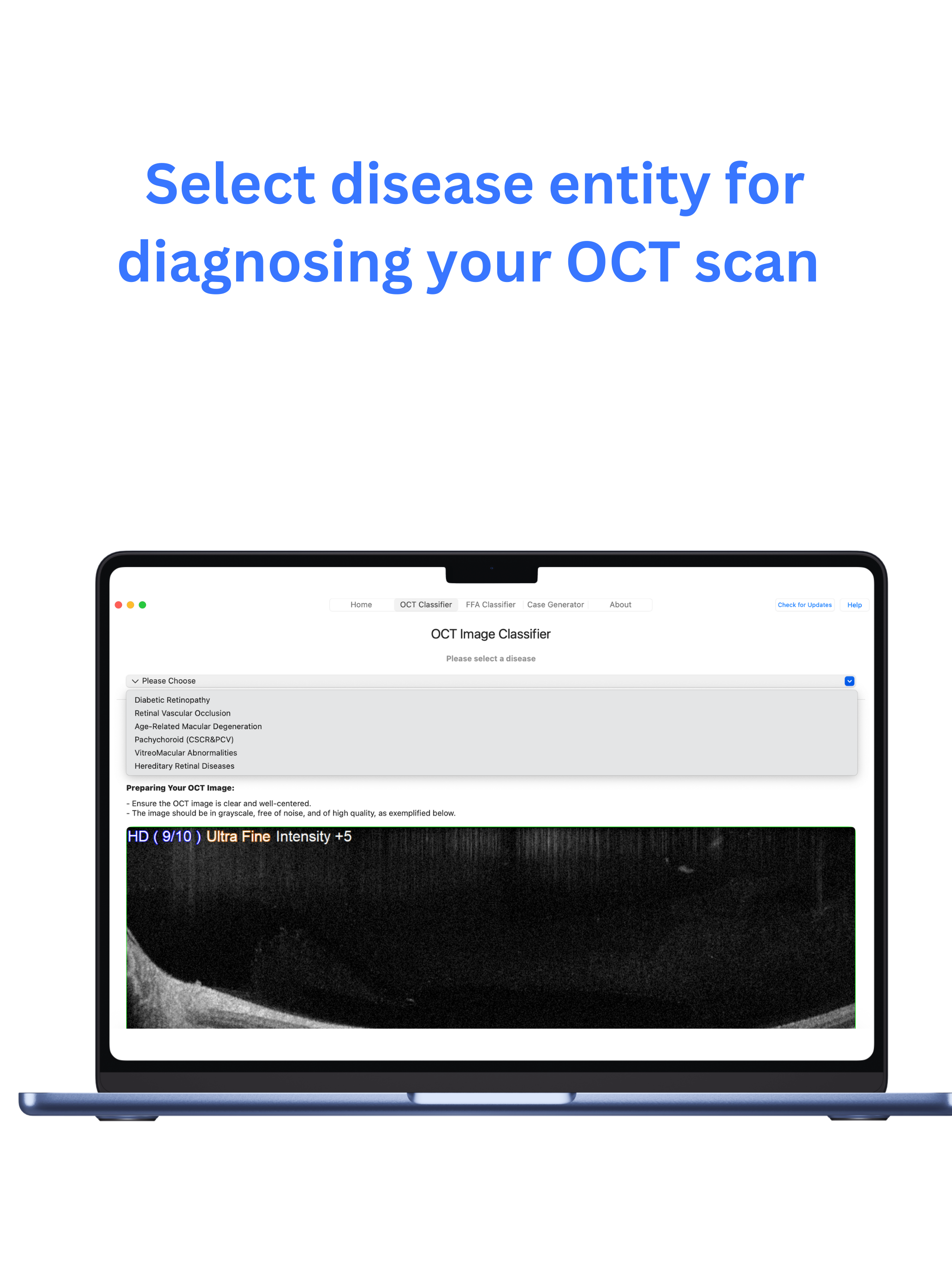 mRetinaAI macOS screenshot 2