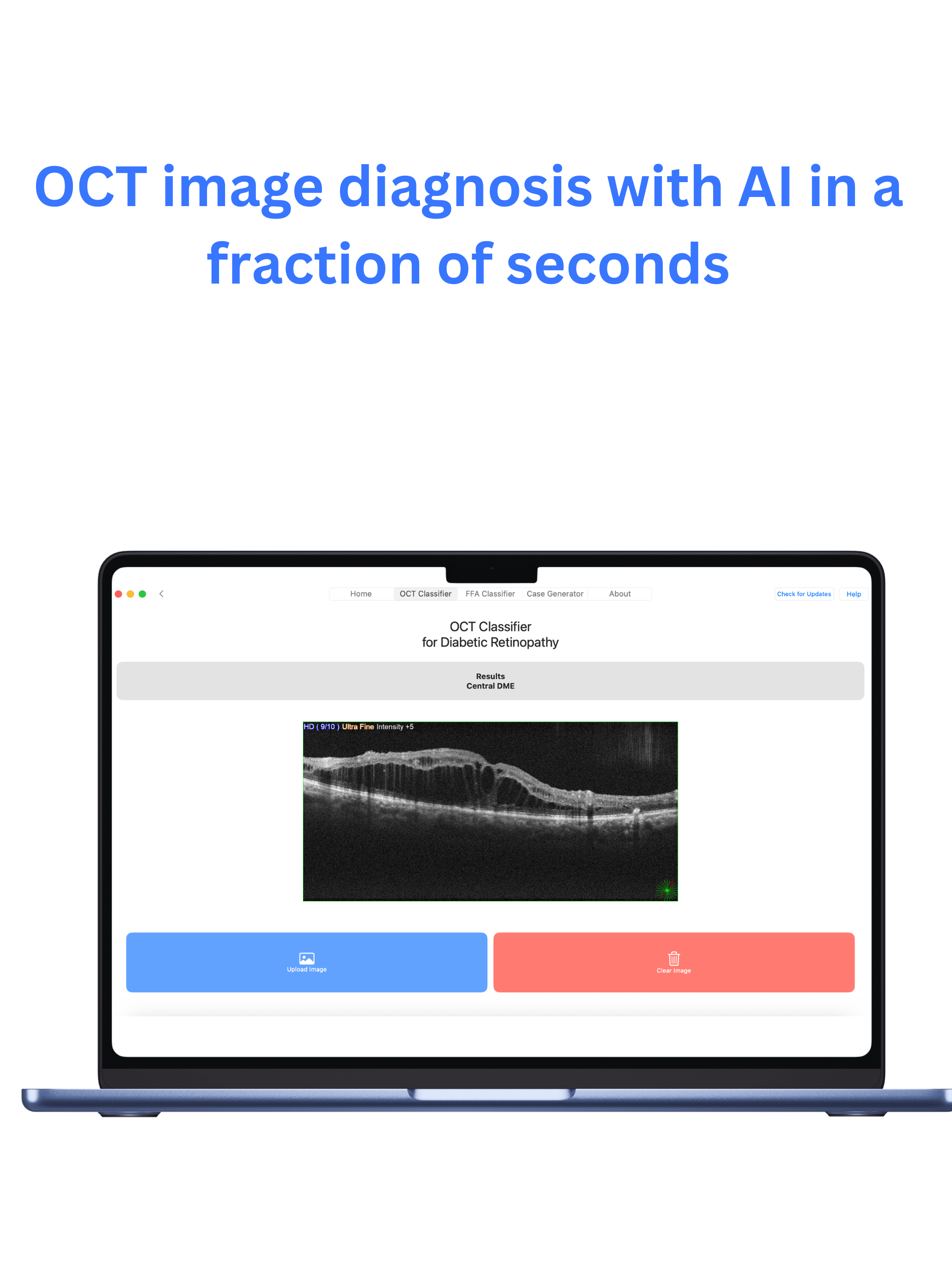 mRetinaAI macOS screenshot 3