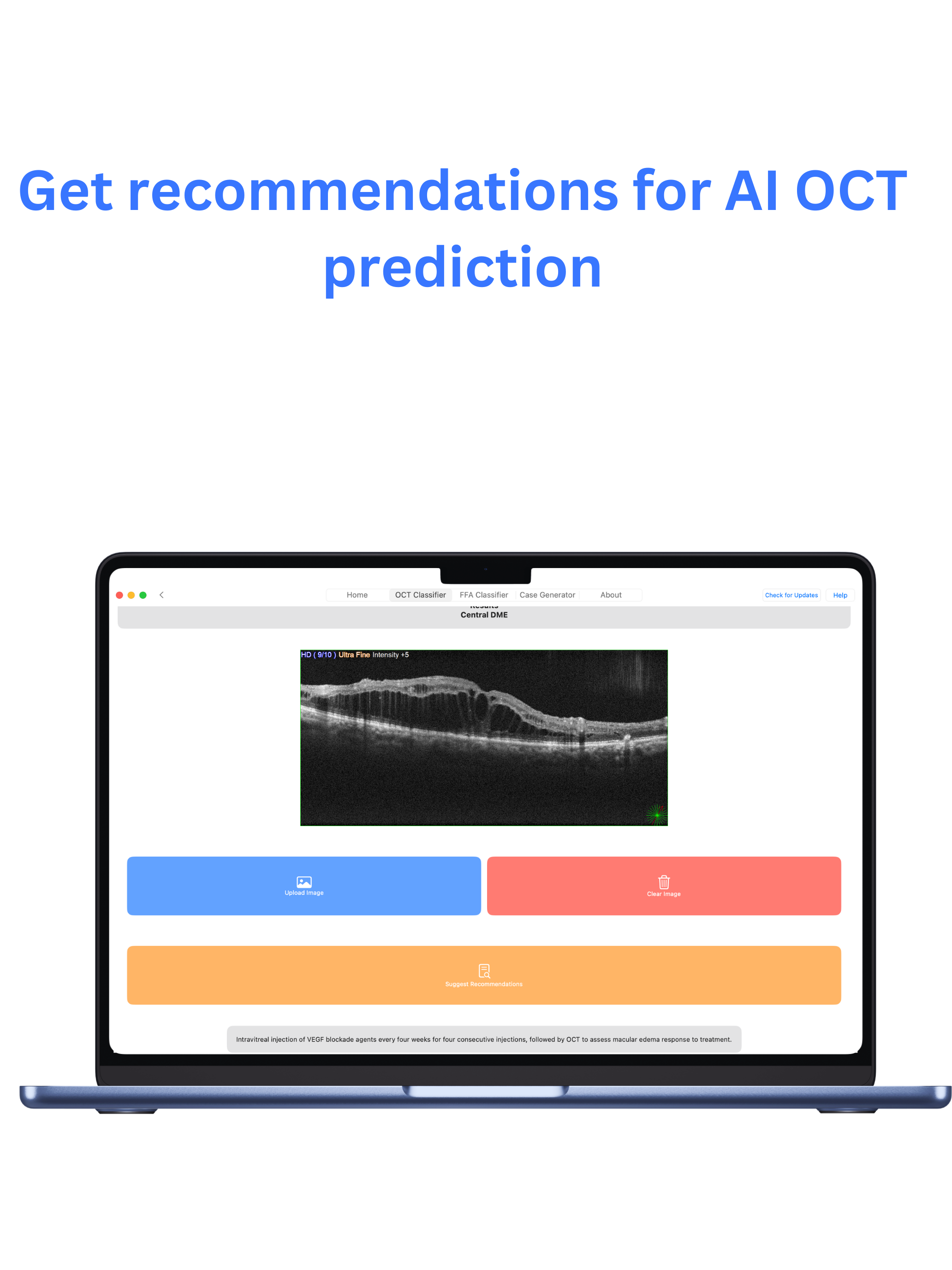 mRetinaAI macOS screenshot 4