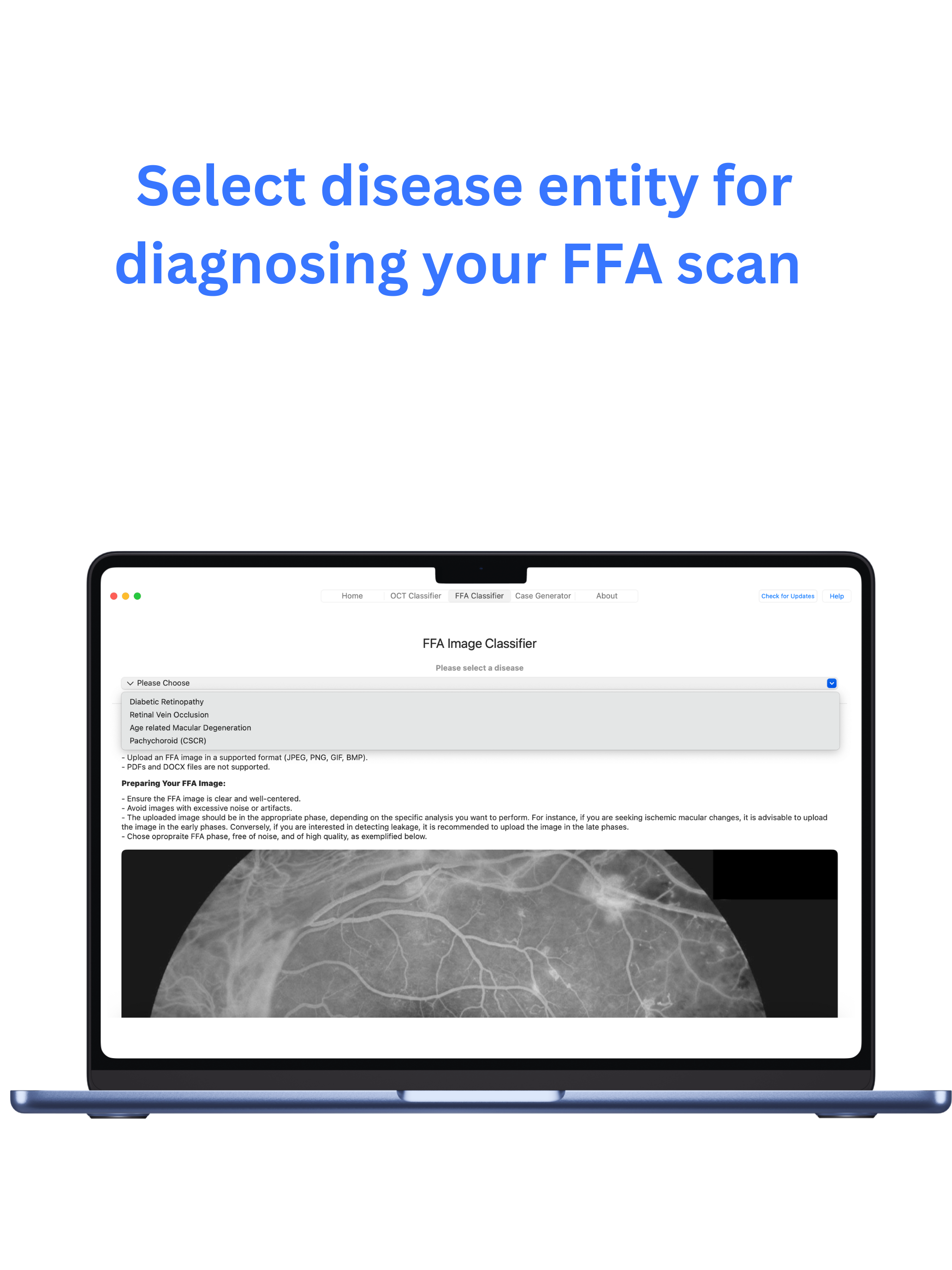mRetinaAI macOS screenshot 5