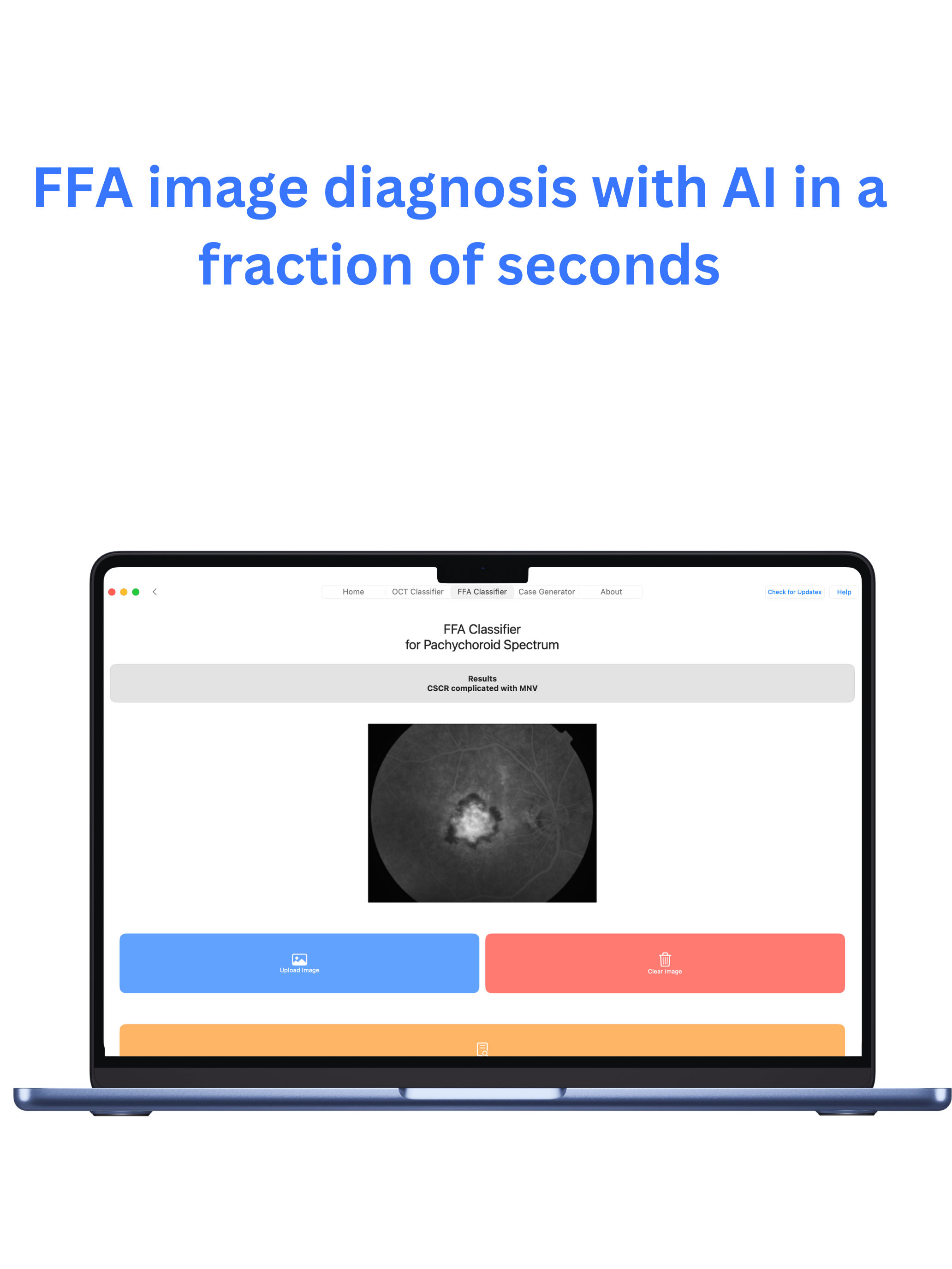 mRetinaAI macOS screenshot 6