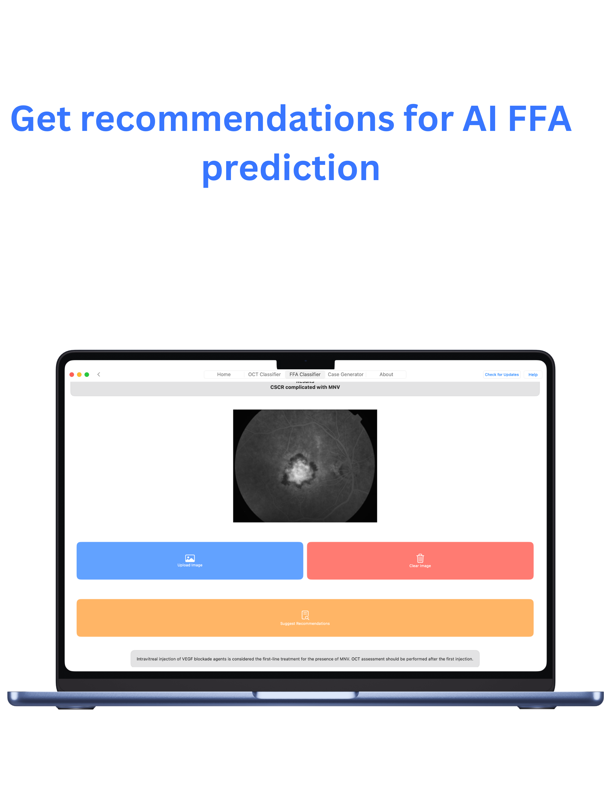 mRetinaAI macOS screenshot 7