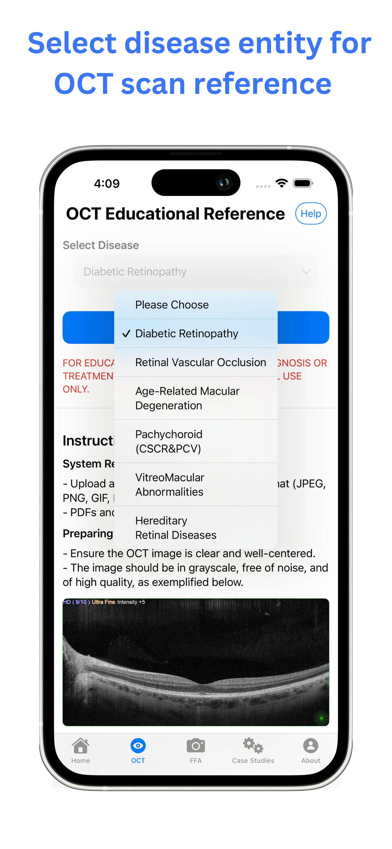 mRetinaLearn screenshot 1