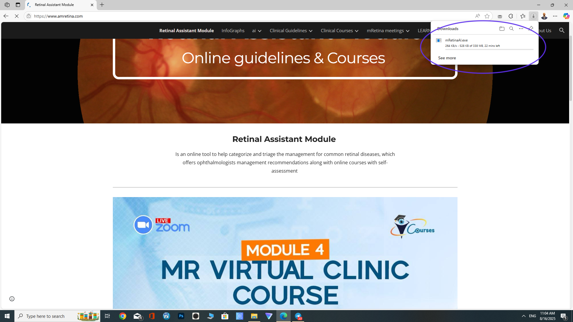 Downloads folder with mRetinaAI installer