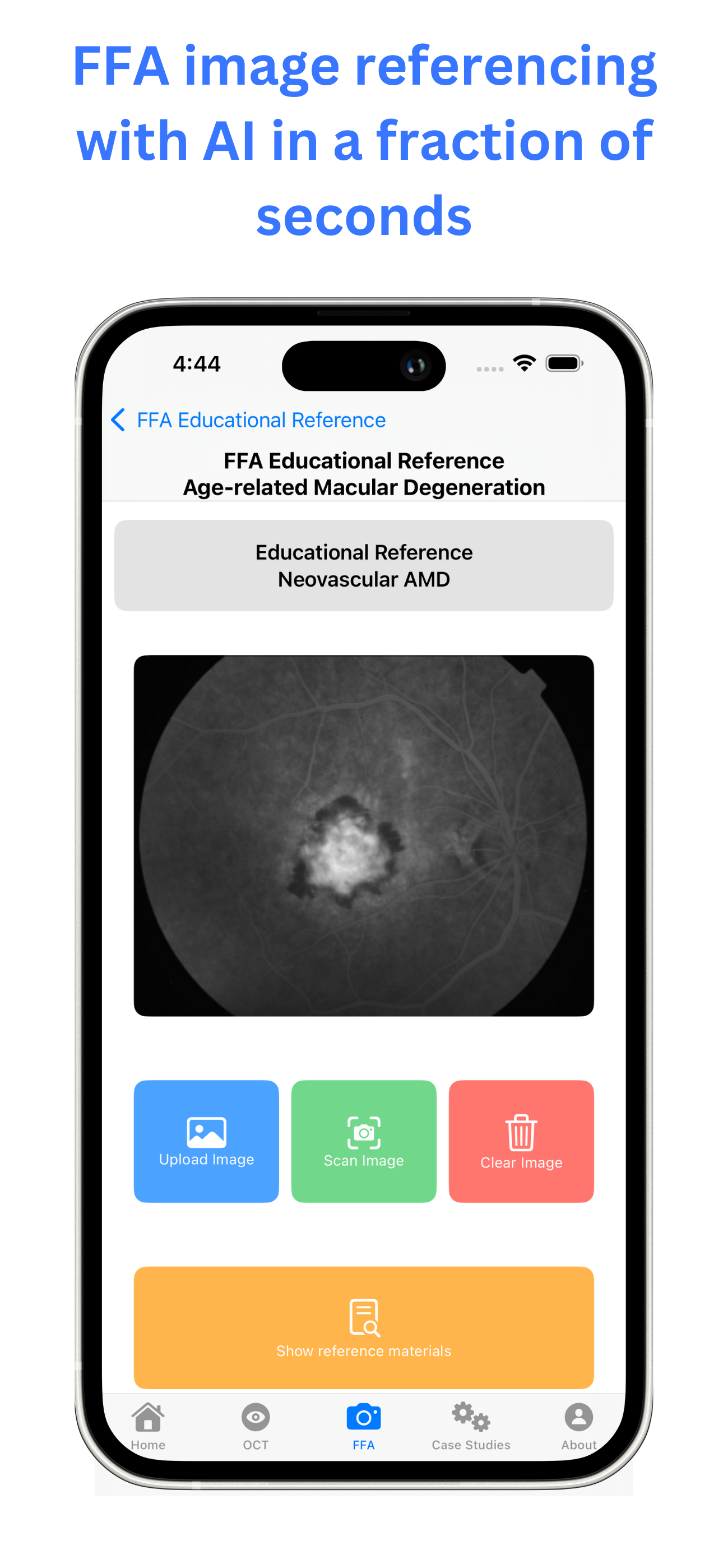 mRetinaLearn screenshot 5