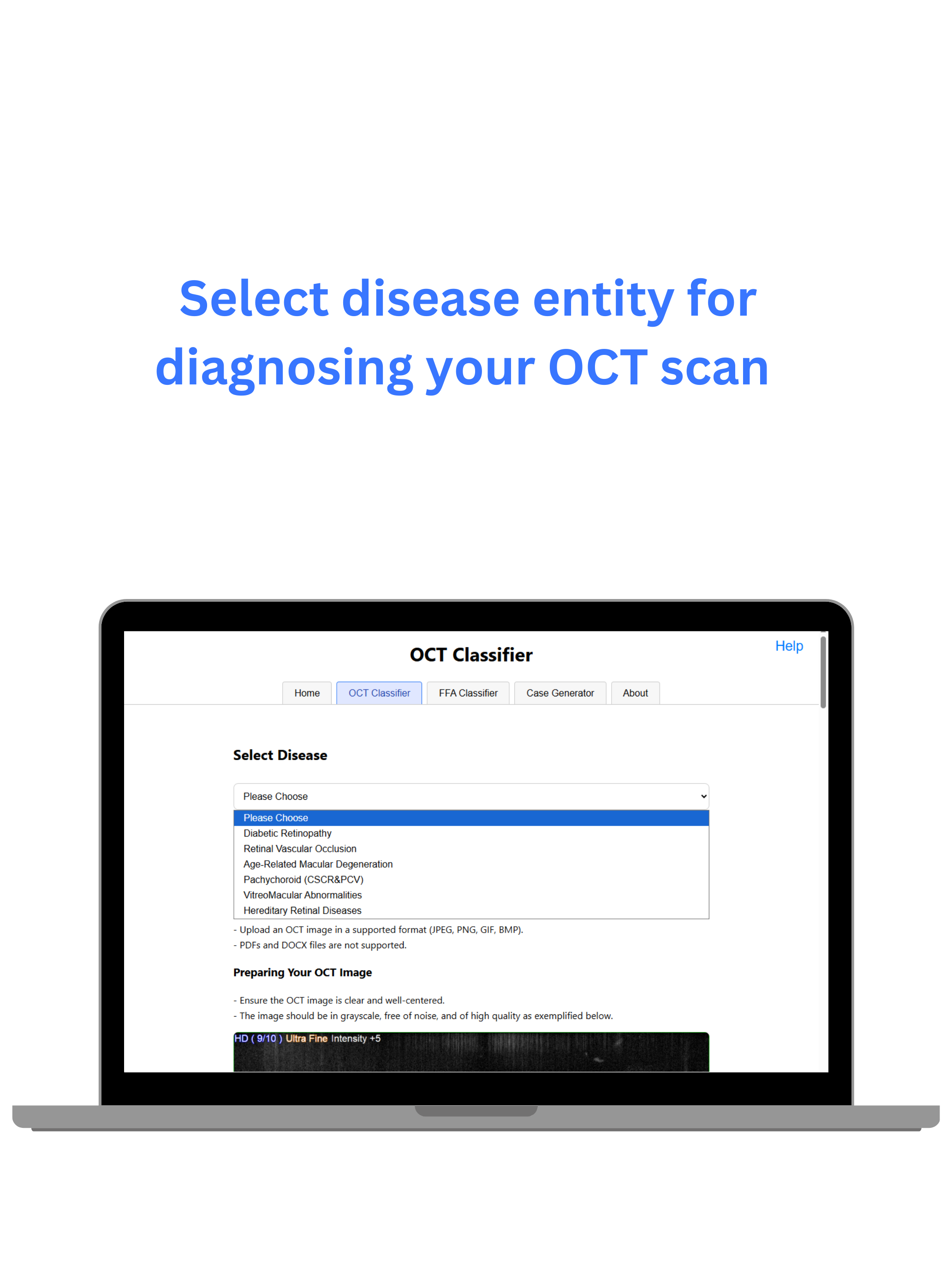 mRetinaAI screenshot 1