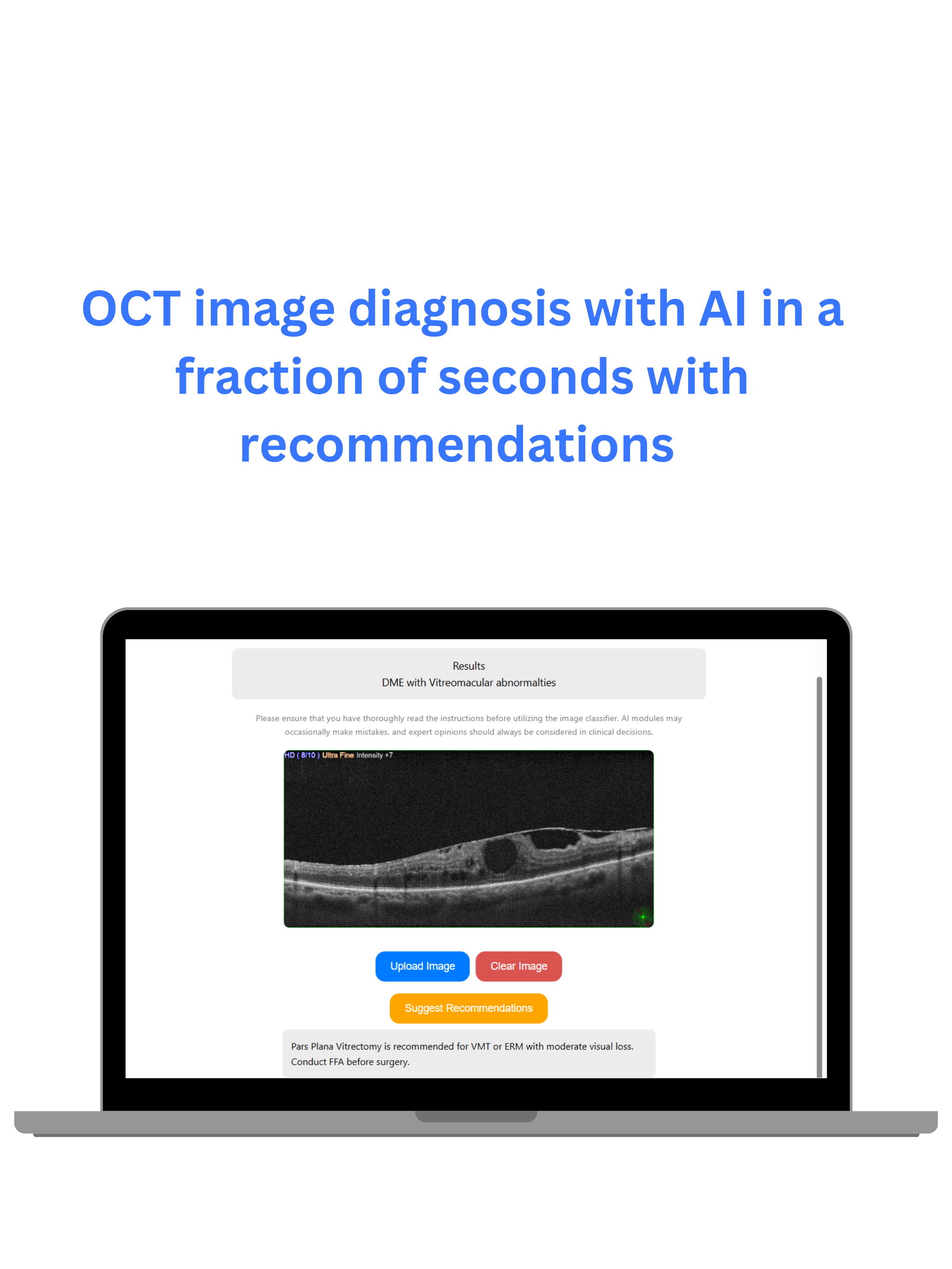 mRetinaAI screenshot 2