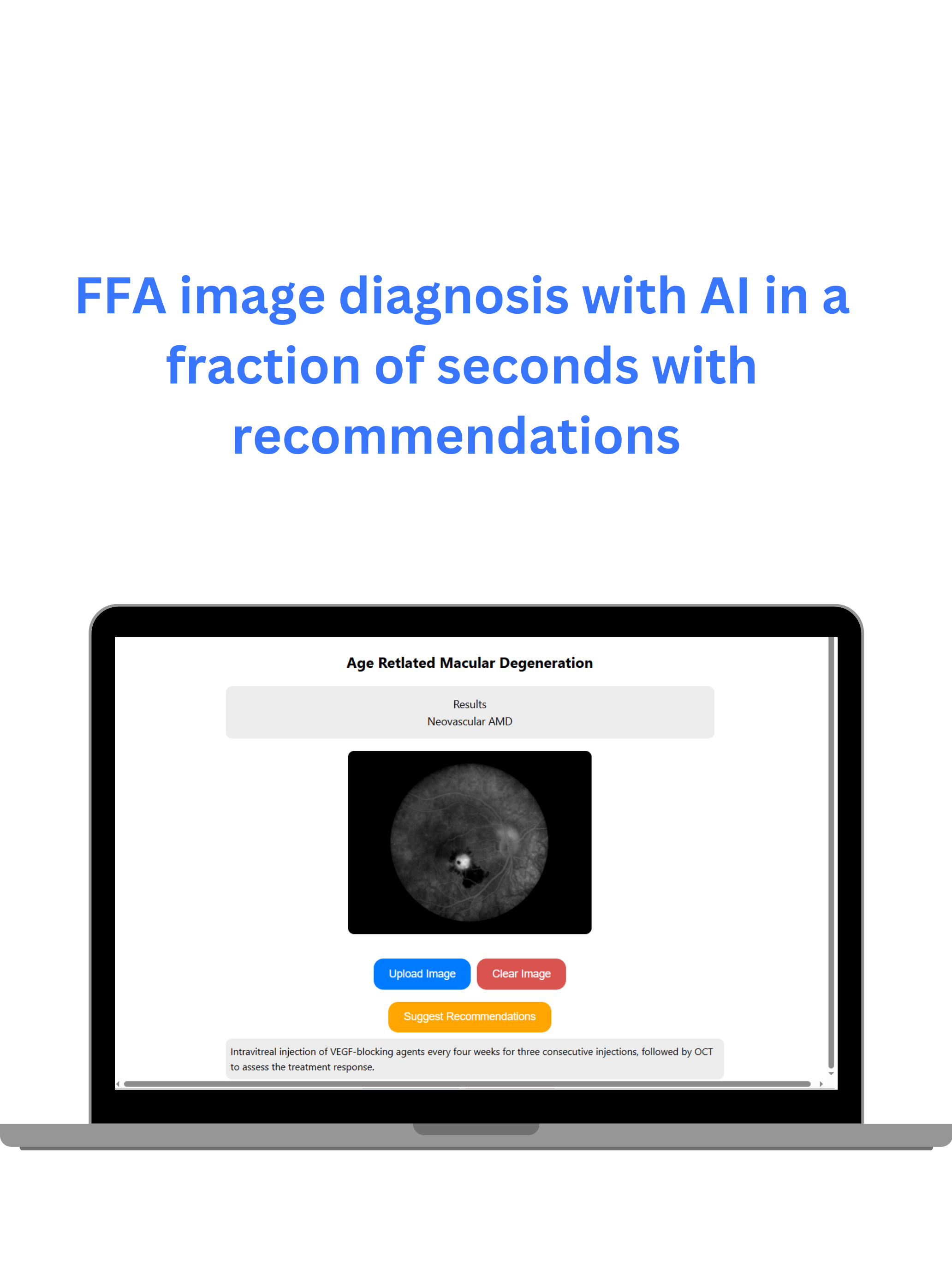 mRetinaAI screenshot 4