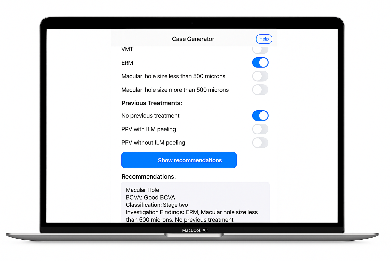 Case Generator preview