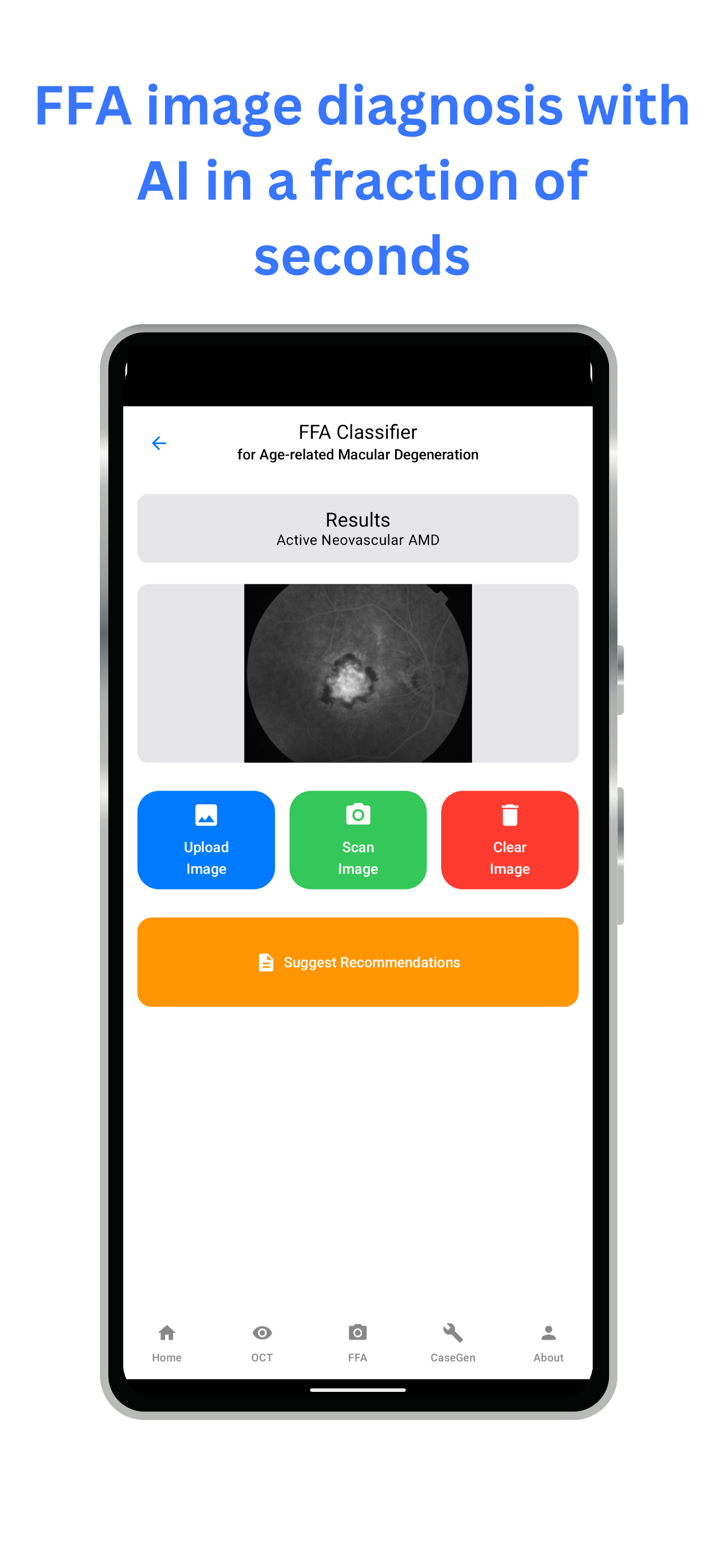 mRetinaAI screenshot 7