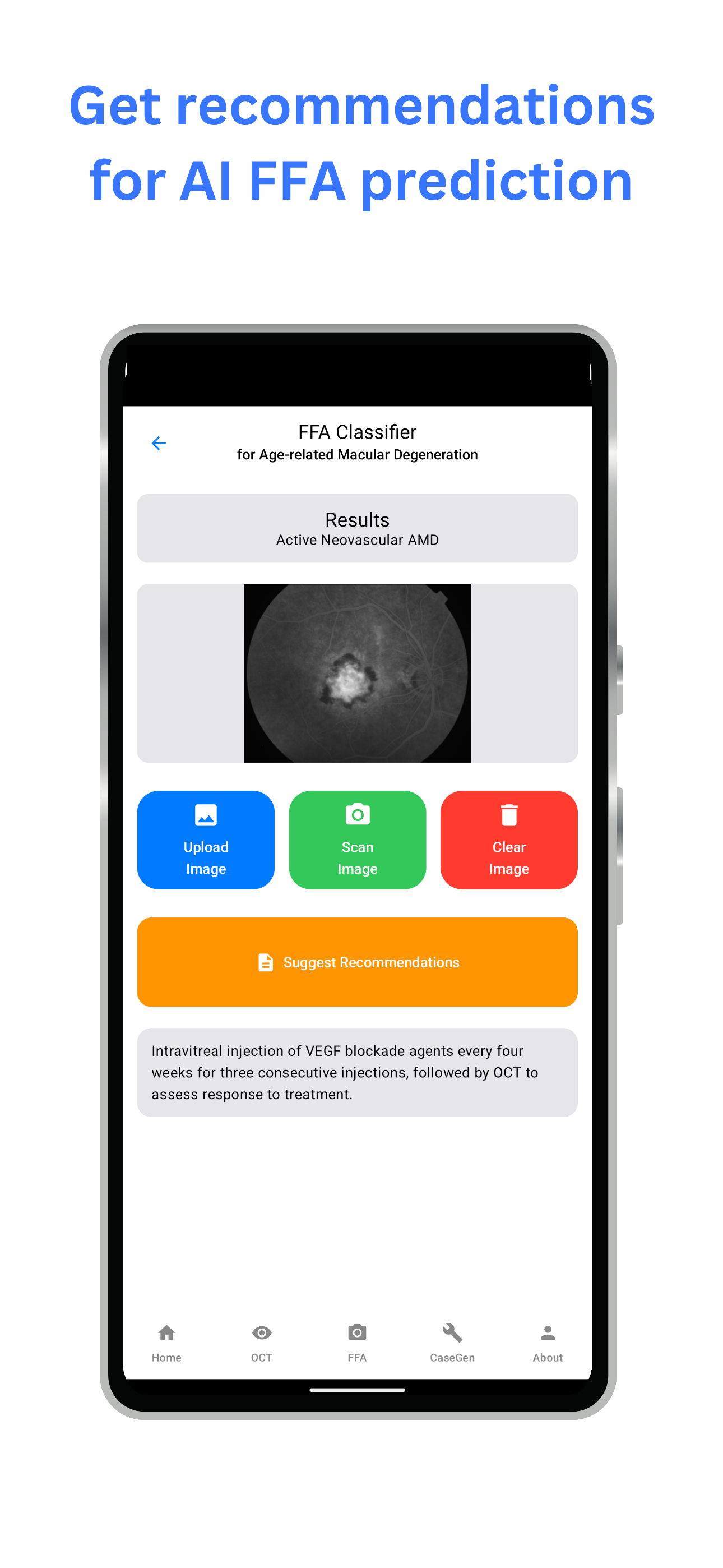 mRetinaAI screenshot 2