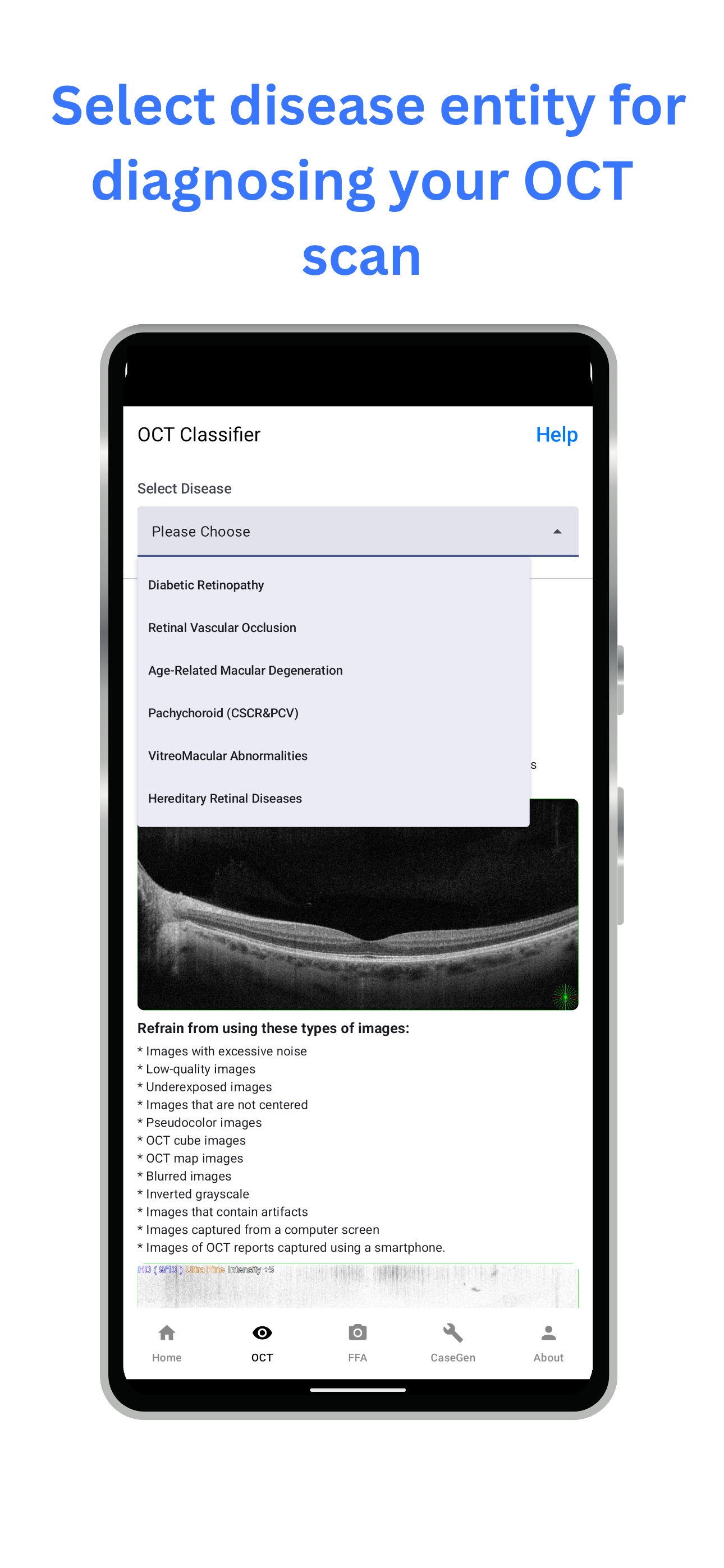 mRetinaAI screenshot 1
