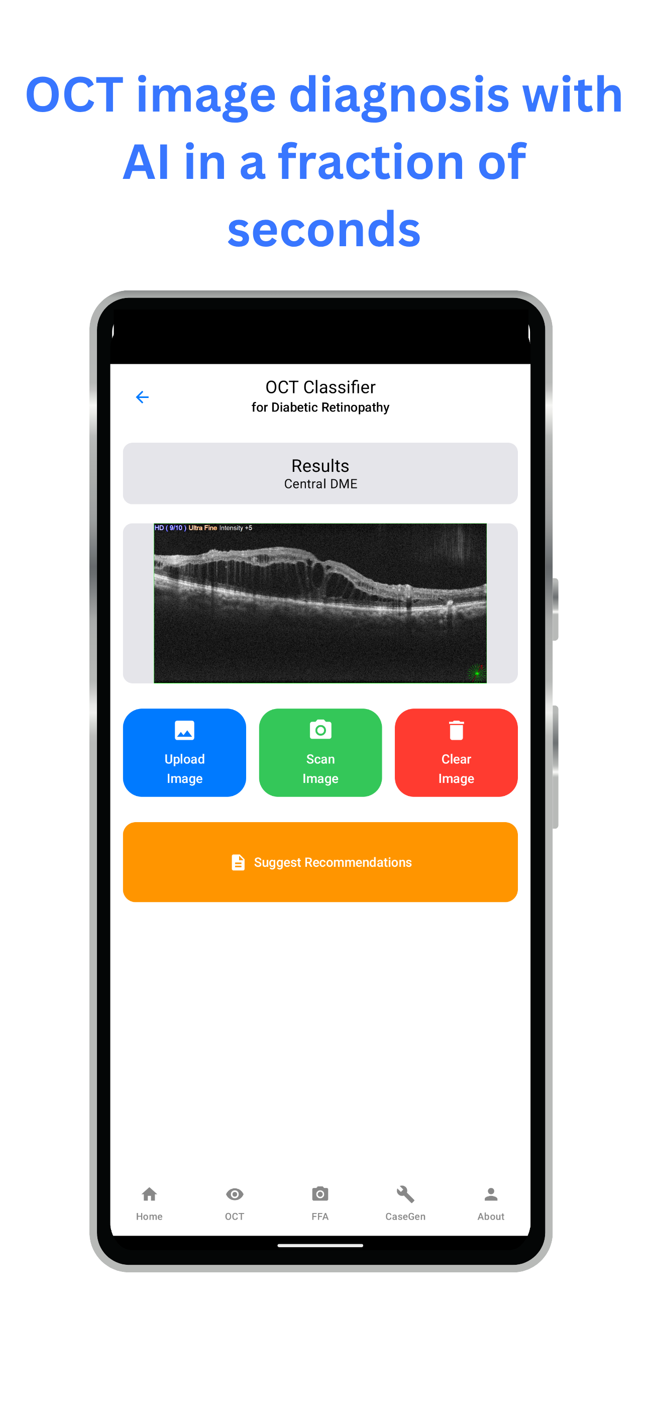 mRetinaAI screenshot 3