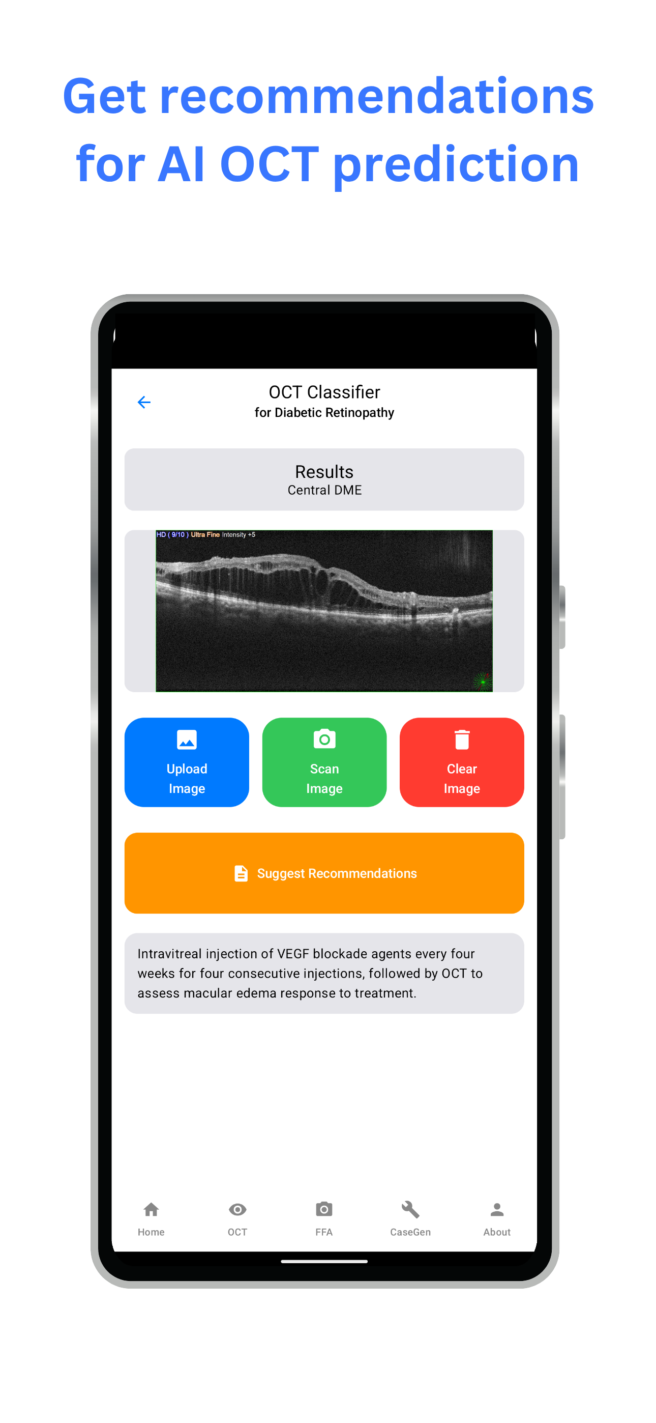mRetinaAI screenshot 4