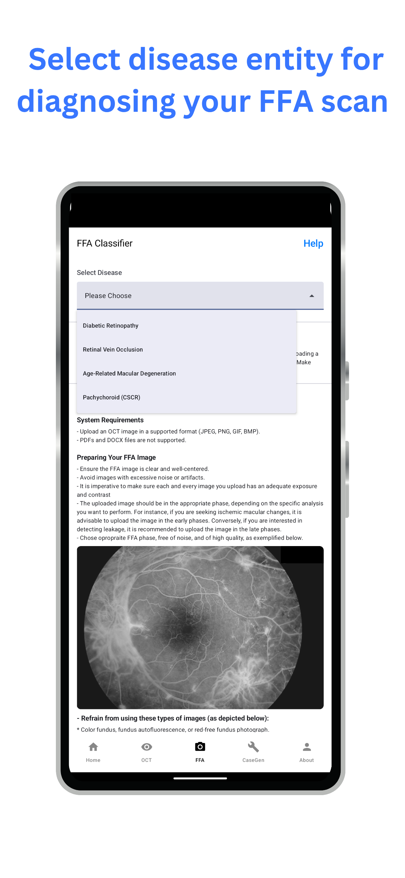 mRetinaAI screenshot 6